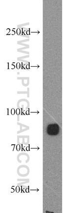 ARHGAP10 Antibody in Western Blot (WB)