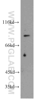 ARHGAP10 Antibody in Western Blot (WB)