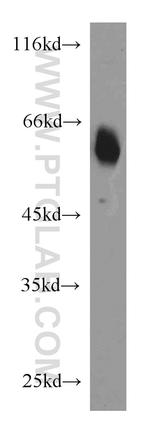 CaMKII gamma Antibody in Western Blot (WB)