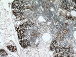 PSMB11 Antibody in Immunohistochemistry (Paraffin) (IHC (P))