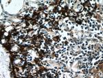 PSMB11 Antibody in Immunohistochemistry (Paraffin) (IHC (P))