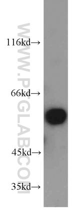 PPP3CA Antibody in Western Blot (WB)