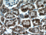 PPP3CB Antibody in Immunohistochemistry (Paraffin) (IHC (P))