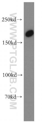 TULP4 Antibody in Western Blot (WB)