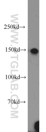 XDH Antibody in Western Blot (WB)