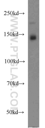 XDH Antibody in Western Blot (WB)