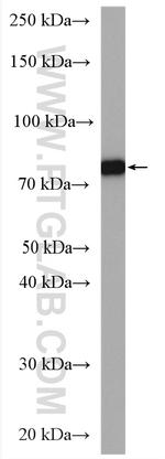 IDUA Antibody in Western Blot (WB)