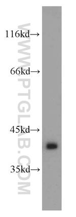 GNAT1 Antibody in Western Blot (WB)