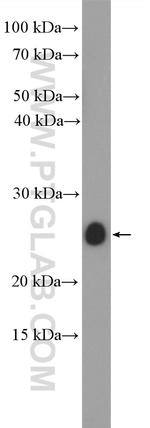 IL11 Antibody in Western Blot (WB)