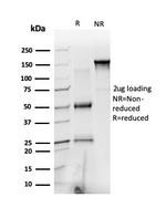 PRMT6 Antibody in SDS-PAGE (SDS-PAGE)