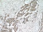 SMURF1 Antibody in Immunohistochemistry (Paraffin) (IHC (P))