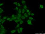 FBXO43 Antibody in Immunocytochemistry (ICC/IF)