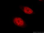 THOC2 Antibody in Immunocytochemistry (ICC/IF)