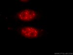 THOC2 Antibody in Immunocytochemistry (ICC/IF)