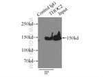 THOC2 Antibody in Immunoprecipitation (IP)