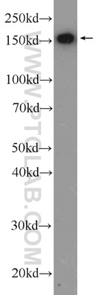 THOC2 Antibody in Western Blot (WB)