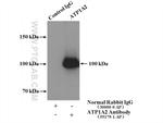 ATP1A2 Antibody in Immunoprecipitation (IP)