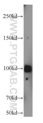 ATP1A2 Antibody in Western Blot (WB)