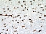 PTBP1 Antibody in Immunohistochemistry (Paraffin) (IHC (P))