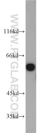 PTBP1 Antibody in Western Blot (WB)