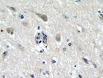 p150 glued Antibody in Immunohistochemistry (Paraffin) (IHC (P))