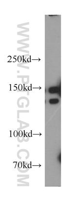 p150 glued Antibody in Western Blot (WB)