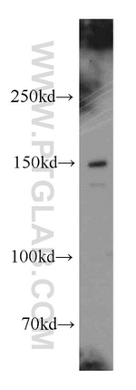 p150 glued Antibody in Western Blot (WB)