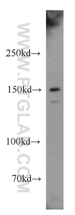 p150 glued Antibody in Western Blot (WB)