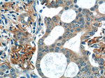 WNT5A/B Antibody in Immunohistochemistry (Paraffin) (IHC (P))