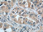 WNT5A/B Antibody in Immunohistochemistry (Paraffin) (IHC (P))