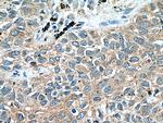 WNT5A/B Antibody in Immunohistochemistry (Paraffin) (IHC (P))