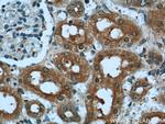 DARC Antibody in Immunohistochemistry (Paraffin) (IHC (P))