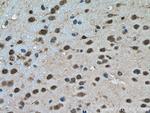 PTBP2 Antibody in Immunohistochemistry (Paraffin) (IHC (P))