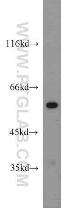 PTBP2 Antibody in Western Blot (WB)