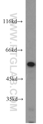 PTBP2 Antibody in Western Blot (WB)