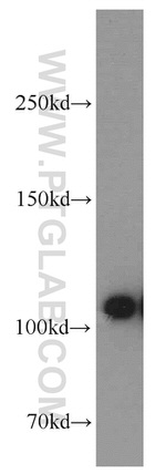 ATP1A1 Antibody in Western Blot (WB)