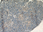 IQGAP2 Antibody in Immunohistochemistry (Paraffin) (IHC (P))