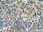 IQGAP2 Antibody in Immunohistochemistry (Paraffin) (IHC (P))