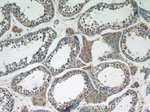 IQGAP2 Antibody in Immunohistochemistry (Paraffin) (IHC (P))