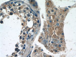 IQGAP2 Antibody in Immunohistochemistry (Paraffin) (IHC (P))