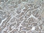 IQGAP2 Antibody in Immunohistochemistry (Paraffin) (IHC (P))