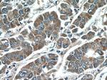 IQGAP2 Antibody in Immunohistochemistry (Paraffin) (IHC (P))