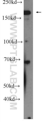 IQGAP2 Antibody in Western Blot (WB)