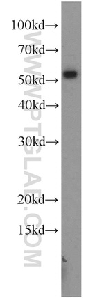 ATGL Antibody in Western Blot (WB)