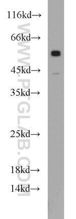 ATGL Antibody in Western Blot (WB)