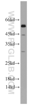 ATGL Antibody in Western Blot (WB)