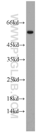 ATGL Antibody in Western Blot (WB)