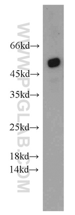 ATGL Antibody in Western Blot (WB)