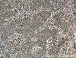 EWS Antibody in Immunohistochemistry (Paraffin) (IHC (P))