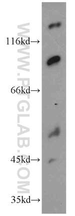 EWS Antibody in Western Blot (WB)